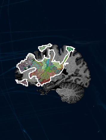 The Salience Network